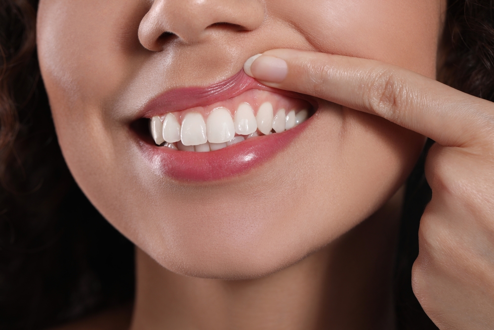 healthy gum tissue